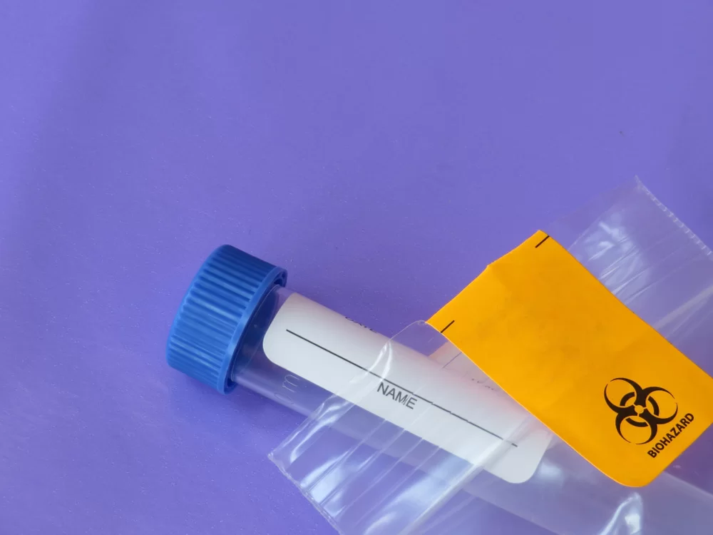 Evde Sperm Test Kitleri Ne Kadar Güvenilir? Birleşik Krallık’tan Uzman Görüşü